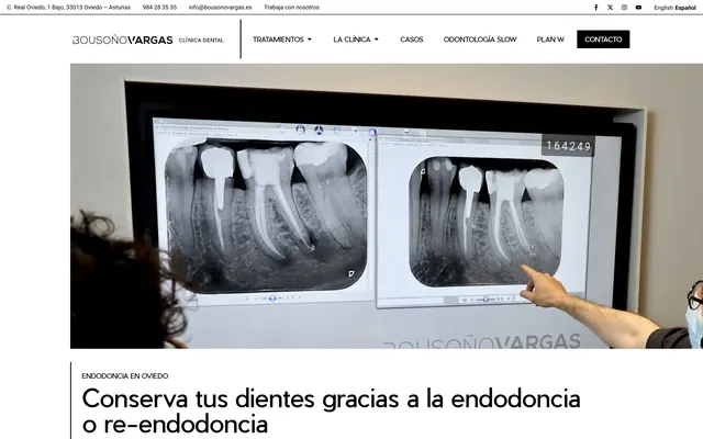 Web de Bousoño Vargas: Endodoncia